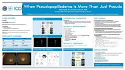 When Pseudopapilledema Is More Than Just Pseudo